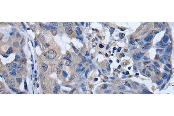 PLK4 antibody