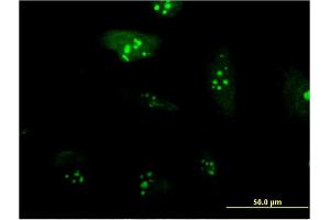 Immunofluorescence of monoclonal antibody to RPL23A on HeLa cell. (RPL23A antibody  (AA 59-156))