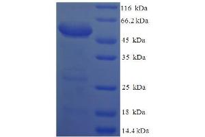 SDS-PAGE (SDS) image for Syndecan 1 (SDC1) (AA 23-257), (Extracellular) protein (GST tag) (ABIN5710322) (Syndecan 1 Protein (SDC1) (AA 23-257, Extracellular) (GST tag))