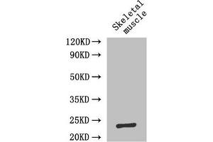 Western Blot Positive WB detected in: Mouse skeletal muscle tissue All lanes: IL6 antibody at 2 μg/mL Secondary Goat polyclonal to rabbit IgG at 1/50000 dilution Predicted band size: 24 kDa Observed band size: 24 kDa (IL-6 antibody  (AA 30-212))