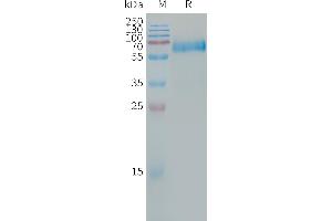 Human CA Protein, hFc Tag on SDS-PAGE under reducing condition. (CLEC5A Protein (Fc Tag))