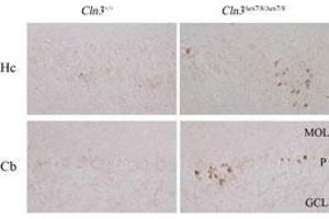 Immunohistochemistry (Paraffin-embedded Sections) (IHC (p)) image for anti-Microtubule-Associated Protein 1 Light Chain 3 alpha (MAP1LC3A) (AA 1-30), (N-Term) antibody (ABIN388473)