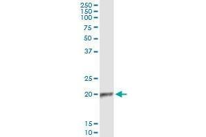 Immunoprecipitation of APOBEC3C transfected lysate using mouse monoclonal anti-APOBEC3C and Protein A Magnetic Bead (APOBEC3C (Human) IP-WB Antibody Pair)