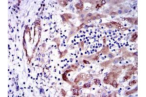 Immunohistochemistry (IHC) image for anti-Glutathione S-Transferase mu 1 (GSTM1) antibody (ABIN969180)