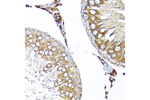 Immunohistochemistry of paraffin-embedded rat testis using TST Rabbit pAb  at dilution of 1:200 (40x lens). (TST antibody  (AA 1-297))