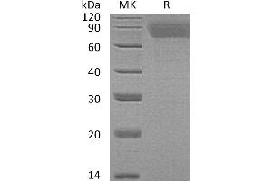 Greater than 95 % as determined by reducing SDS-PAGE. (TPO protein (His tag))