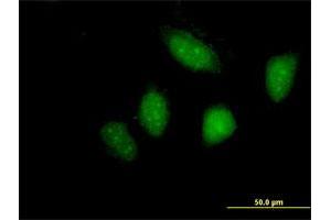 Immunofluorescence of purified MaxPab antibody to LYN on HeLa cell. (LYN antibody  (AA 1-512))