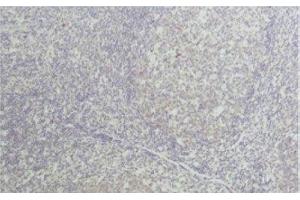 Immunohistochemical analysis of paraffin-embedded Human tonsil tissue using TNF alpha Monoclonal Antibody at dilution of 1:50. (TNF alpha antibody)