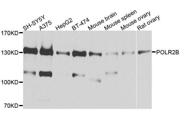 POLR2B antibody  (AA 1-260)