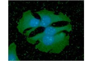 ICC/IF analysis of PDPN in HaLe cells. (Podoplanin antibody)