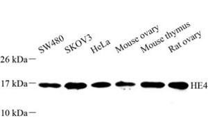 Western blot analysis of HE4 (ABIN7076209) at dilution of 1: 500 (WFDC2 antibody)