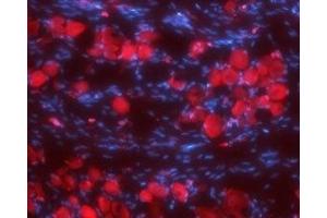 Expression of Synaptophysin in rat DRG - Immunohistochemical staining of rat dorsal root ganglia (DRG) frozen sections using Anti-Synaptophysin Antibody (ABIN7043791, ABIN7044656 and ABIN7044657), (1:100). (Synaptophysin antibody  (Intravesicular Loop))