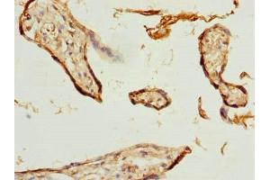 Immunohistochemistry of paraffin-embedded human placenta tissue using ABIN7176183 at dilution of 1:100 (ZNF232 antibody  (AA 1-417))
