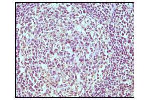 Immunohistochemical analysis of paraffin-embedded human normal lymph node, showing cytoplasmic localization using CD19 mouse mAb with DAB staining. (CD19 antibody)