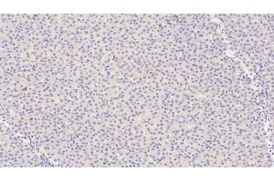Detection of ANGPT1 in Human Liver Tissue using Polyclonal Antibody to Angiopoietin 1 (ANGPT1) (Angiopoietin 1 antibody  (AA 284-452))