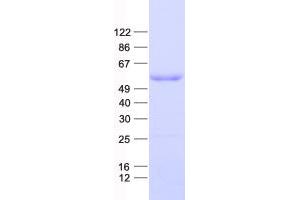 Validation with Western Blot (DP2 Protein (His tag))