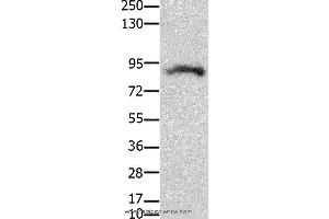 Western blot analysis of Mouse brain tissue, using KCNH2  Polyclonal Antibody at dilution of 1:100 (KCNH2 antibody)