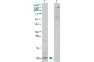 Western Blot analysis of CXCL5 expression in transfected 293T cell line by CXCL5 monoclonal antibody (M03), clone M1. (CXCL5 antibody  (AA 1-114))