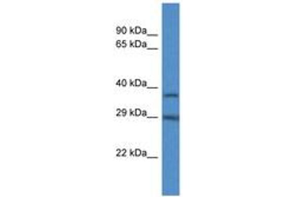 RAB34 antibody  (C-Term)