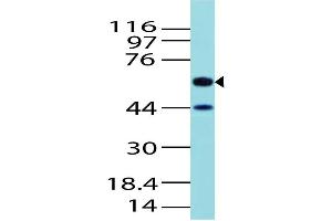Image no. 1 for anti-Activin A Receptor Type II-Like 1 (ACVRL1) (AA 326-503) antibody (ABIN5027021) (ACVRL1 antibody  (AA 326-503))