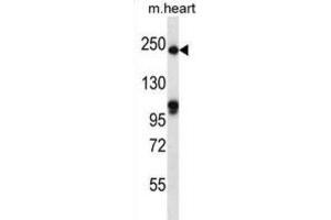 Western Blotting (WB) image for anti-Slit Homolog 1 (SLIT1) antibody (ABIN2997309) (SLIT1 antibody)