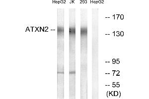 Western blot analysis of extracts from HepG2 cells, Jurkat cells and 293 cells, using ATXN2 antibody. (Ataxin 2 antibody)