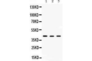 Western blot analysis of AMACR expression in rat kidney extract ( Lane 1), rat liver extract ( Lane 2) and HEPG2 whole cell lysates ( Lane 3). (AMACR antibody  (Middle Region))