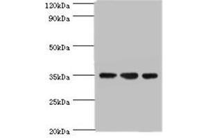 Western blot All lanes: AIMP2 antibody at 5 μg/mL Lane 1: Hela whole cell lysate Lane 2: HepG2 whole cell lysate Lane 3: K562 whole cell lysate Secondary Goat polyclonal to rabbit IgG at 1/10000 dilution Predicted band size: 35 kDa Observed band size: 35 kDa (AIMP2 antibody  (AA 141-320))