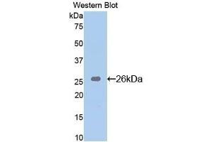 使用BH3相互作用域死亡激动剂（Bid）多克隆抗体（Bid抗体（AA 1-195））检测重组Bid小鼠