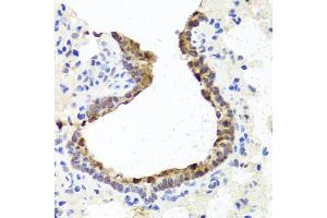 Immunohistochemistry of paraffin-embedded rat lung using TOPBP1 antibody (ABIN6291480) at dilution of 1:100 (40x lens). (TOPBP1 antibody)