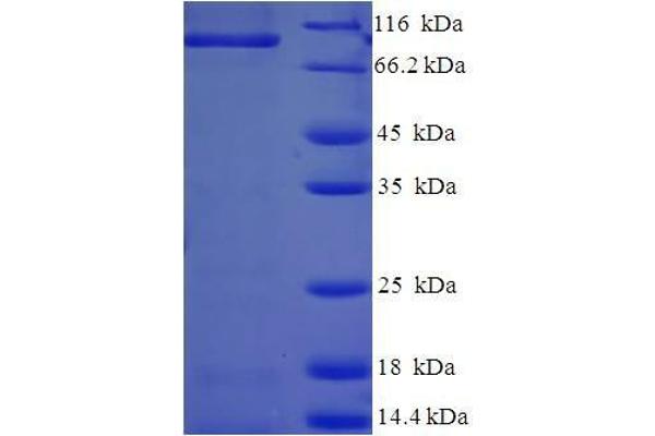 Caprin-1 Protein (AA 2-707) (His tag)