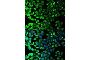 Immunofluorescence analysis of A549 cell using KRT8 antibody. (KRT8 antibody)