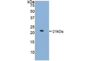 Detection of Recombinant GaA, Human using Polyclonal Antibody to Glucosidase Alpha, Acid (GaA) (GAA antibody  (AA 595-770))