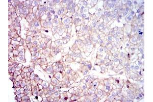 Immunohistochemistry (IHC) image for anti-Coactosin-Like Protein antibody (ABIN969509)