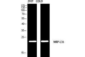 Western blot analysis of 293T COLO using MRP-L35 antibody. (MRPL35 antibody  (AA 80-160))