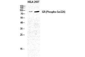 Western Blotting (WB) image for anti-GR (pSer226) antibody (ABIN3173219) (GR (pSer226) antibody)