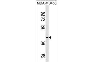 Western blot analysis in MDA-MB453 cell line lysates (35ug/lane). (CCBL1 antibody  (C-Term))