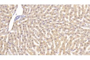 Detection of TNFa in Rabbit Liver Tissue using Monoclonal Antibody to Tumor Necrosis Factor Alpha (TNFa) (TNF alpha antibody  (AA 80-235))