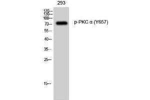 Western Blotting (WB) image for anti-Protein Kinase C, alpha (PKCa) (pTyr657) antibody (ABIN3182236) (PKC alpha antibody  (pTyr657))