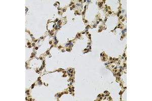 Immunohistochemistry of paraffin-embedded rat lung using IFI16 Antibody (ABIN6291165) at dilution of 1:100 (40x lens). (IFI16 antibody)