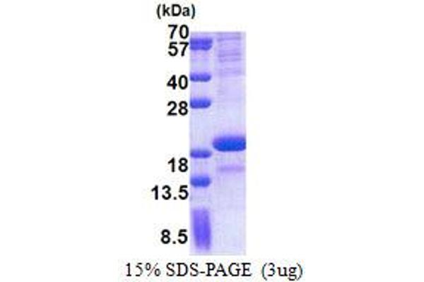 SCN3B Protein (AA 23-159) (His tag)