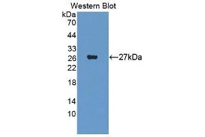 Western blot analysis of recombinant Mouse CORT. (CROT antibody  (AA 410-612))