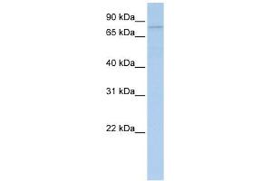 PYGB antibody used at 1 ug/ml to detect target protein. (PYGB antibody  (N-Term))