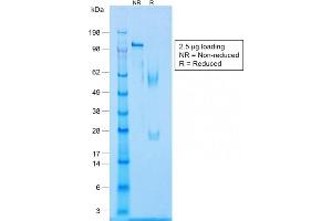 SDS-PAGE (SDS) image for anti-Caldesmon 1 (CALD1) antibody (ABIN6940942)