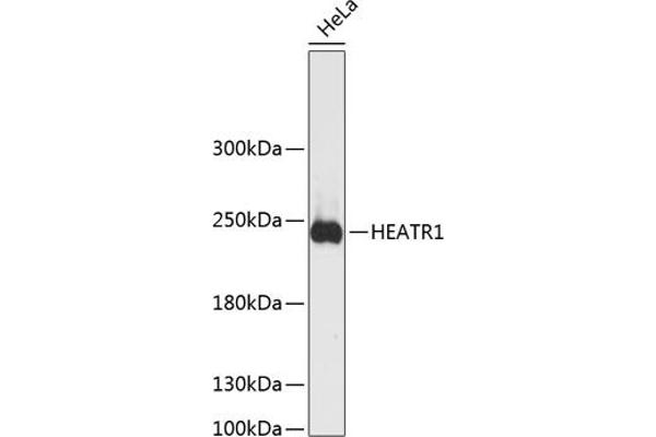 HEATR1 antibody  (AA 1-120)