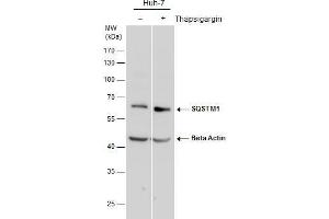 Western Blotting (WB) image for anti-Sequestosome 1 (SQSTM1) antibody (ABIN2854836)