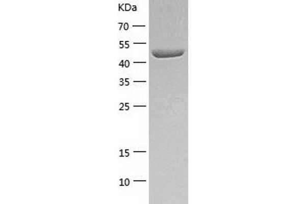 CPE Protein (AA 43-476) (His tag)