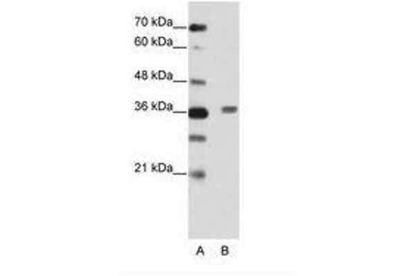 BTBD6 antibody  (AA 87-136)