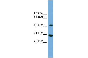 WB Suggested Anti-CRLS1 Antibody Titration:  0. (CRLS1 antibody  (Middle Region))