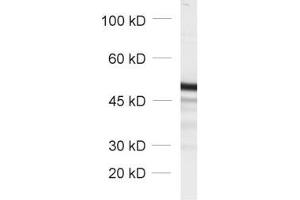 dilution: 1 : 1000, sample: total cell lysate from fibroblasts transfected with a GFP fusion construct (GFP antibody)